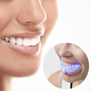 InnovaGoods Professional teeth whitener Acasă